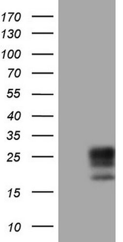 Adiponectin Mouse anti-Human, Clone: OTI3D3, lyophilized, TrueMAB 100 &mu;g;