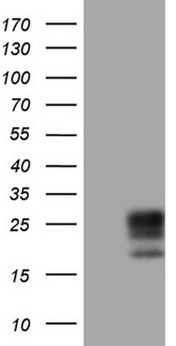 Adiponectin Monoclonal Antibody (OTI3D3), TrueMAB , OriGene 30 &mu;L; Unconjugated:Antibodies,