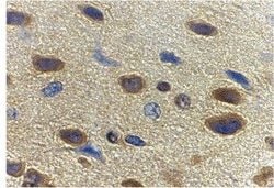 Invitrogen Adiponectin Polyclonal Antibody 100 &mu;g; Unconjugated:Antibodies,