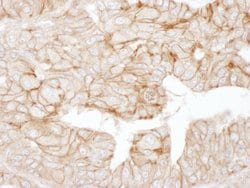 Alpha-Adducin Rabbit anti-Human, Polyclonal, Bethyl Laboratories 100 &mu;L;