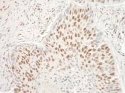Aly Rabbit anti-Human, Polyclonal, Bethyl Laboratories 100 &mu;L; Unconjugated:Antibodies,