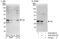 Aly Rabbit anti-Human, Polyclonal, Bethyl Laboratories 100 &mu;L; Unconjugated:Antibodies,