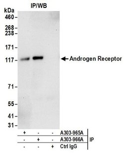 Androgen Receptor Rabbit anti-Human, Polyclonal, Bethyl Laboratories 100