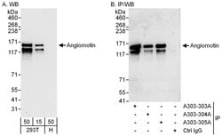 Angiomotin Rabbit anti-Human, Polyclonal, Bethyl Laboratories 100 &mu;l;