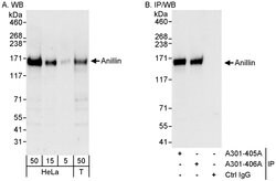 Anillin Rabbit anti-Human, Polyclonal, Bethyl Laboratories 100 &mu;L; Unconjugated:Antibodies,