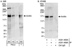 Anillin Rabbit anti-Human, Polyclonal, Bethyl Laboratories 100 &mu;L; Unconjugated:Antibodies,
