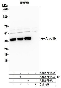 Arpc1b Rabbit anti-Human, Mouse, Polyclonal, Bethyl Laboratories 100 &mu;l;