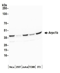Arpc1b Polyclonal Antibody, Bethyl Laboratories:Antibodies:Primary Antibodies