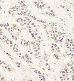 Artemis Polyclonal Antibody, Bethyl Laboratories 10 &mu;L | Buy Online | Bethyl Laboratories, Inc | Fisher Scientific