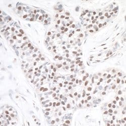 ASH2 Rabbit anti-Human, Mouse, Polyclonal, Bethyl Laboratories 100 &mu;L;