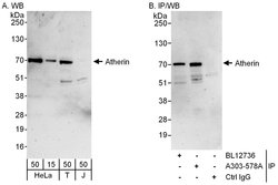 Atherin Rabbit anti-Human, Polyclonal, Bethyl Laboratories 100 &mu;L; Unconjugated:Antibodies,