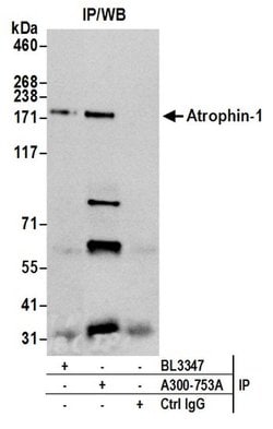 Atrophin 1 Rabbit anti-Human, Polyclonal, Bethyl Laboratories 10 &mu;L;