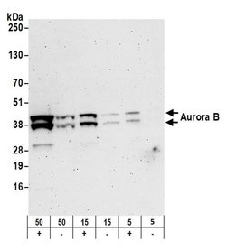 Aurora B Polyclonal Antibody, Bethyl Laboratories 20 &mu;L; Unconjugated:Antibodies,