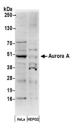 Aurora A Polyclonal Antibody, Bethyl Laboratories 20 &mu;L; Unconjugated:Antibodies,