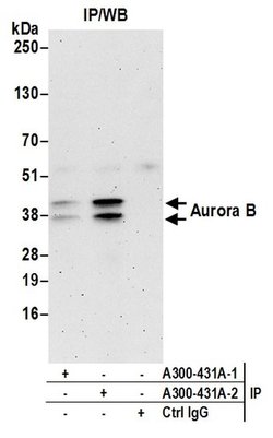 Aurora B Rabbit anti-Human, Polyclonal, Bethyl Laboratories 100 &mu;L;