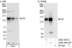 Axl Rabbit anti-Human, Polyclonal, Bethyl Laboratories 100 &mu;L; Unconjugated:Antibodies,