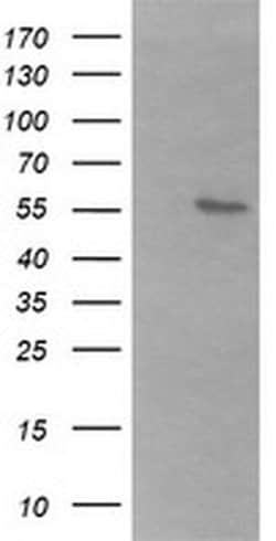 B3GALNT2 Monoclonal Antibody (OTI1G2), TrueMAB , OriGene 100 &mu;L; Unconjugated:Antibodies,
