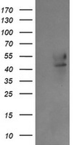 B3GNT2 Monoclonal Antibody (OTI4B9), TrueMAB , OriGene 30 &mu;L | Buy Online | OriGene | Fisher Scientific
