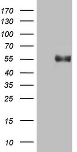 B4GALT3 Monoclonal Antibody (OTI1G9), TrueMAB , OriGene 100 &mu;L; Unconjugated:Antibodies,