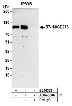 CD276 Rabbit anti-Human, Polyclonal, Bethyl Laboratories 100 &mu;L; Unconjugated:Antibodies,