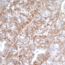 B7-H3/CD276 Recombinant Rabbit Monoclonal Antibody (BLR025F), Bethyl Laboratories