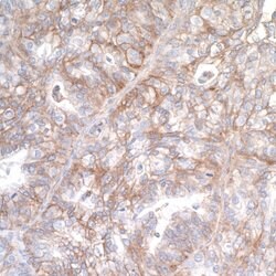 B7-H3/CD276 Recombinant Rabbit Monoclonal Antibody (BLR026F), Bethyl Laboratories