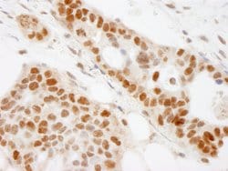 BAAT1 Rabbit anti-Human, Polyclonal, Bethyl Laboratories 100 &mu;L; Unconjugated:Antibodies,