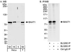 BAAT1 Rabbit anti-Human, Polyclonal, Bethyl Laboratories 100 &mu;L; Unconjugated:Antibodies,