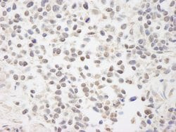 BAAT1 Polyclonal Antibody, Bethyl Laboratories:Antibodies:Primary Antibodies