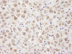 BAAT1 Polyclonal Antibody, Bethyl Laboratories 100 &mu;L; Unconjugated:Antibodies,