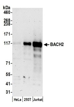 BACH2 Polyclonal Antibody, Bethyl Laboratories 20 &mu;L; Unconjugated:Antibodies,