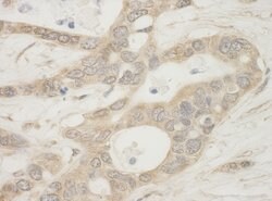 BAD Polyclonal Antibody, Bethyl Laboratories:Antibodies:Primary Antibodies