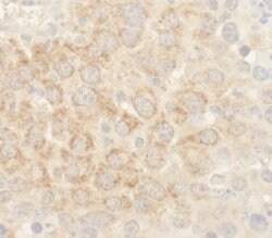 BAD Polyclonal Antibody, Bethyl Laboratories 10 &mu;L; Unconjugated:Antibodies,