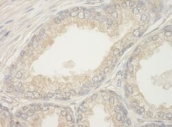 BAD Polyclonal Antibody, Bethyl Laboratories 10 &mu;L; Unconjugated:Antibodies,