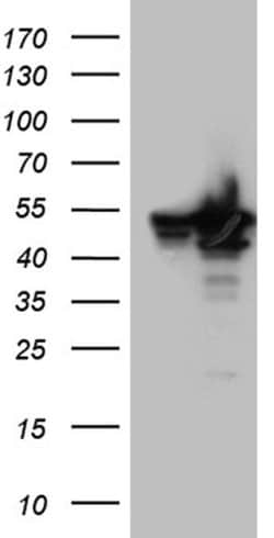 BAG5 Monoclonal Antibody (OTI2D6), TrueMAB , OriGene:Antibodies:Primary