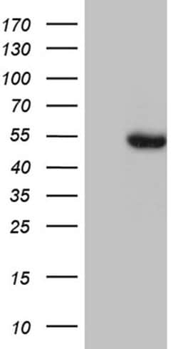 BAG5 Monoclonal Antibody (OTI5F1), TrueMAB , OriGene 100 &mu;L; Unconjugated:Antibodies,