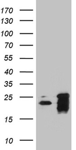 BAX Mouse anti-Human, Clone: OTI2A1, lyophilized, TrueMAB 100 &mu;g; Unconjugated:Antibodies,