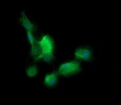 BBOX1 Monoclonal Antibody (OTI4F9), TrueMAB , OriGene 100 &mu;L; Unconjugated:Antibodies,