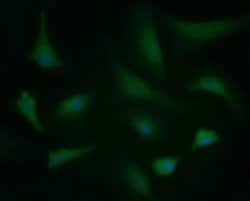 BBOX1 Monoclonal Antibody (OTI2C8), TrueMAB , OriGene 100 &mu;L; Unconjugated:Antibodies,