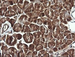 BBOX1 Monoclonal Antibody (OTI4F9), TrueMAB , OriGene 100 &mu;L; Unconjugated:Antibodies,