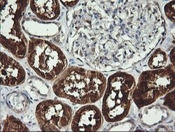 BBOX1 Monoclonal Antibody (OTI4F9), TrueMAB , OriGene 100 &mu;L; Unconjugated:Antibodies,