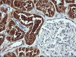 BBOX1 Monoclonal Antibody (OTI2G1), TrueMAB , OriGene 100 &mu;L; Unconjugated:Antibodies,