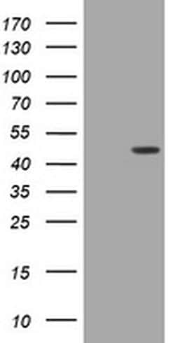 BBOX1 Monoclonal Antibody (OTI1D6), TrueMAB , OriGene 30 &mu;L | Buy Online | Origene Technologies | Fisher Scientific