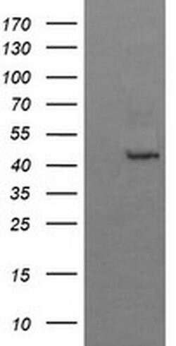 BBOX1 Monoclonal Antibody (OTI2C8), TrueMAB , OriGene 100 &mu;L; Unconjugated:Antibodies,