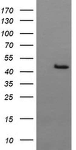 BBOX1 Monoclonal Antibody (OTI2G1), TrueMAB , OriGene 100 &mu;L; Unconjugated:Antibodies,