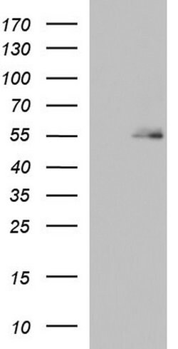 BBS4 Monoclonal Antibody (OTI2D5), TrueMAB , OriGene 100 &mu;L; Unconjugated:Antibodies,
