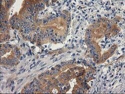 BCAR1 Monoclonal Antibody (OTI3A5), TrueMAB , OriGene 100 &mu;L; Unconjugated:Antibodies,