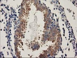 BCAR1 Monoclonal Antibody (OTI1B1), TrueMAB , OriGene 30 &mu;L; Unconjugated:Antibodies,