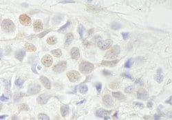 BCAS3 Polyclonal Antibody, Bethyl Laboratories 10 &mu;L; Unconjugated:Antibodies,