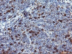 BCAT1 Mouse anti-Canine, Human, Mouse, Clone: OTI3F5, lyophilized, TrueMAB